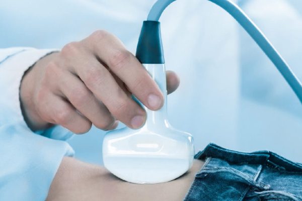 transrektal-ultrason