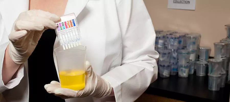 uyusturucu-madde-testi