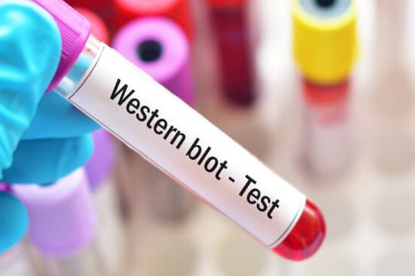 western-blot-testi