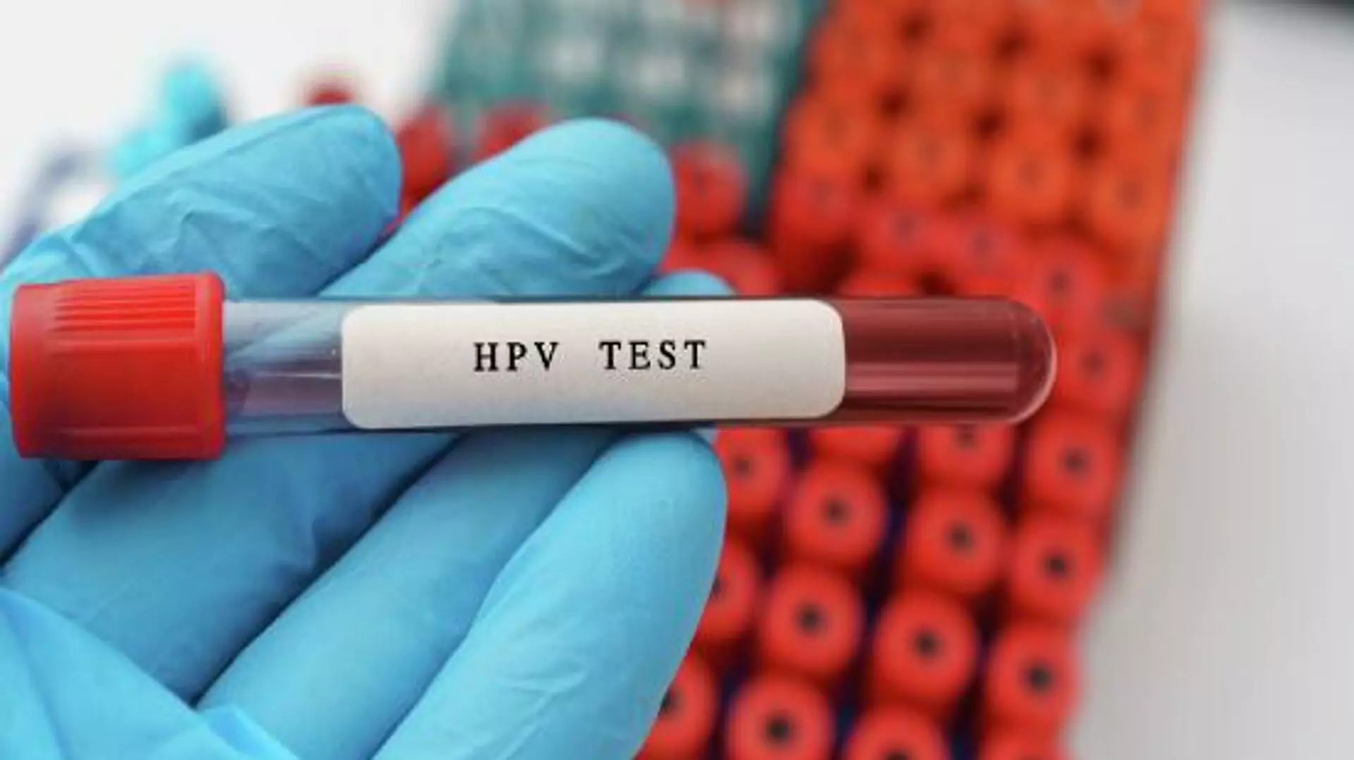 Hpv Testi hpv testi