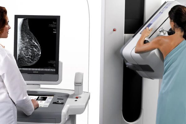 mammography