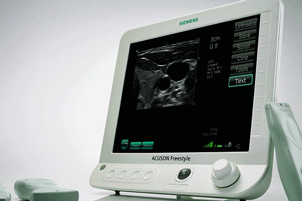 ultrasonography