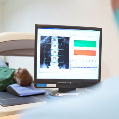 dexa