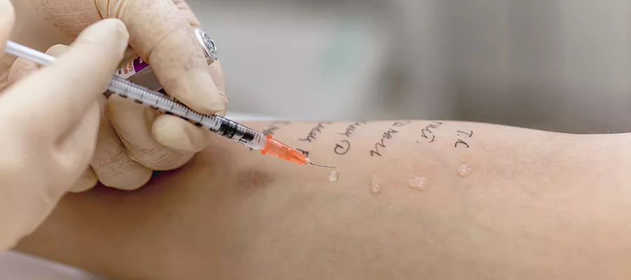 alerji-testi-690dfa9fc778e