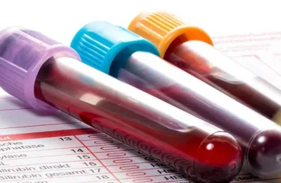 gida-intolerans-testi-6900c39be3967