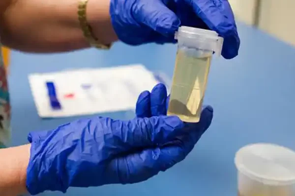 Uyuşturucu Testinden Önce Dikkat Edilmesi Gereken 5 Şey